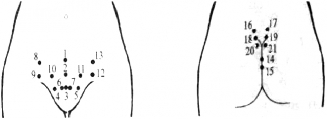 На эти точки ставят пиявок при женских заболеваниях