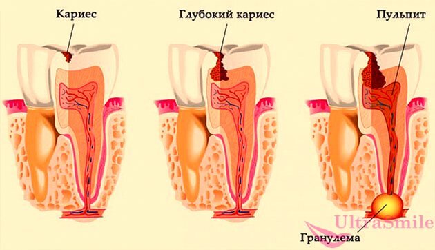 Лучше не доводить до такого!