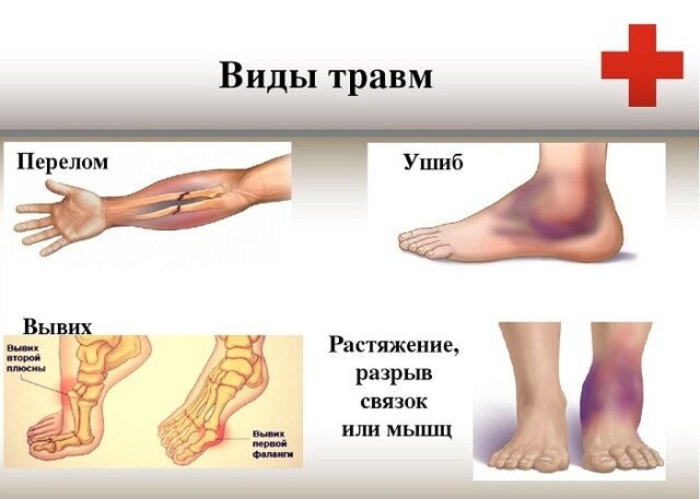 Ушиб ноги у ребенка - признаки, симптомы и лечение в «СМ-Клиника» для детей и подростков