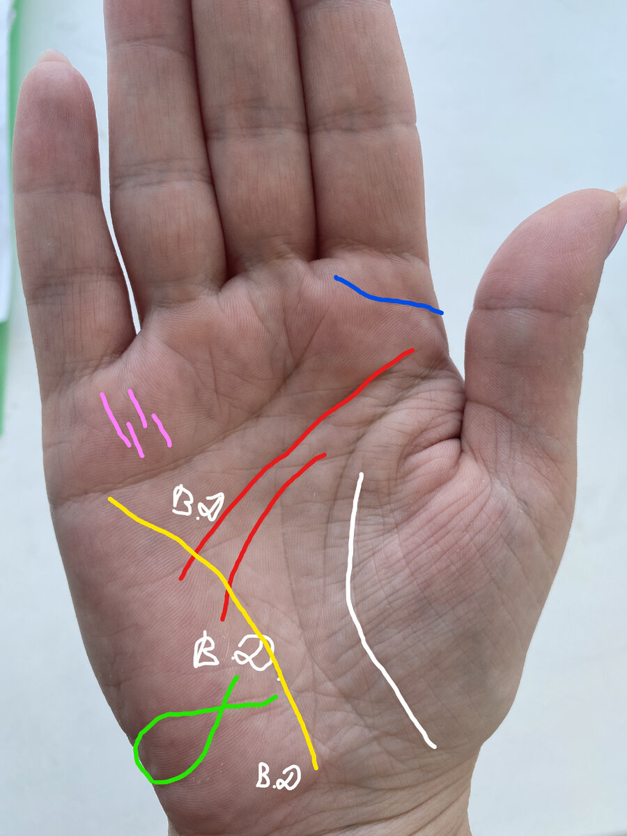 Неуспешная эмиграция на руке. Пример линии эмиграции на фото/Хиромантия