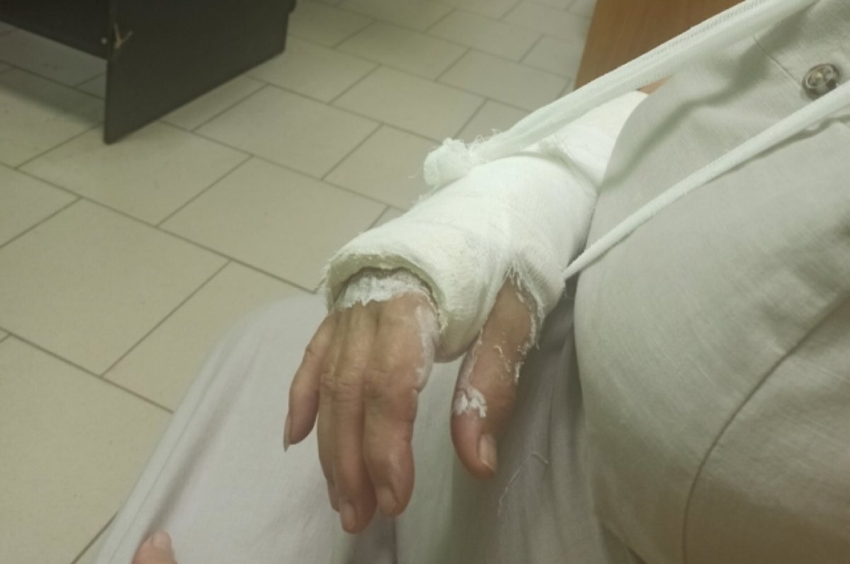    В Твери женщина получила перелом руки после нападения пьяного мужчины