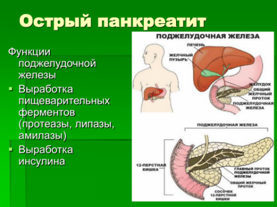 Острый панкреатит