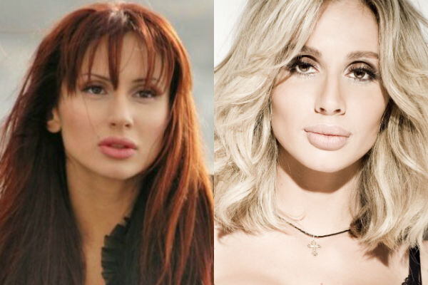 Светлана до и после пластики