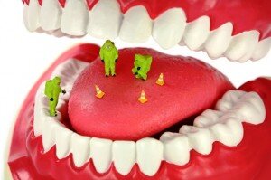 Запах изо рта, как признак пародонтита