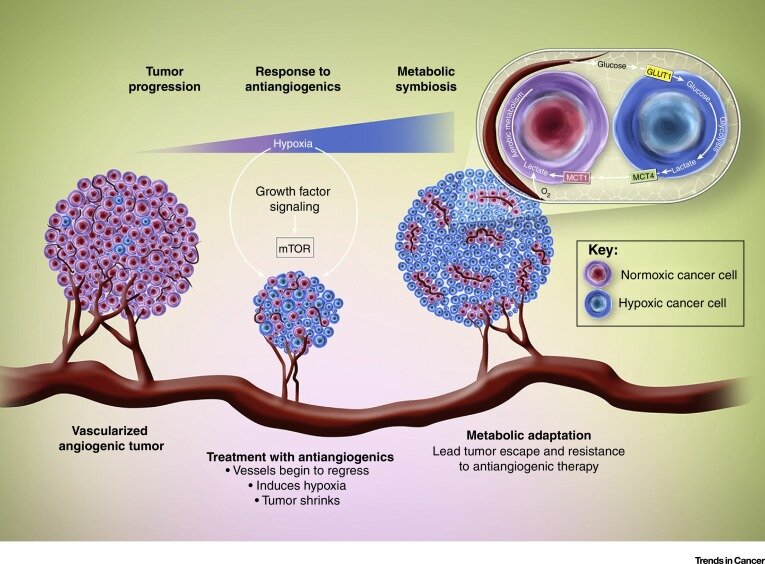 Например, одним из способов опухоли защититься от лекарственных препаратов - это соединить в симбиозе ангиогенез (рост новых кровеносных сосудов) и метаболизм.  В опухоли возникают гипоксические области (расположены далеко от кровеносных сосудов) - сильно гликолитические и производят высокое количество лактата. Напротив, нормоксические области (близкие к кровеносным сосудам) поглощают избыток лактата и метаболизировать его путем аэробного митохондриального дыхания. Этот взаимный баланс позволяет: опухоли уклоняются от антиангиогенной терапии и продолжают расти. 