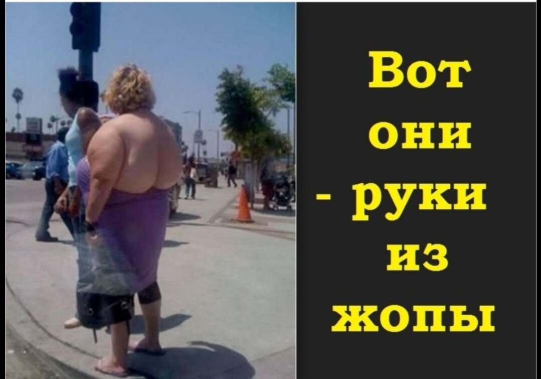 И вот они. Руки из задницы прикол. Человек у которого руки растут из задницы. Рукожопая женщина