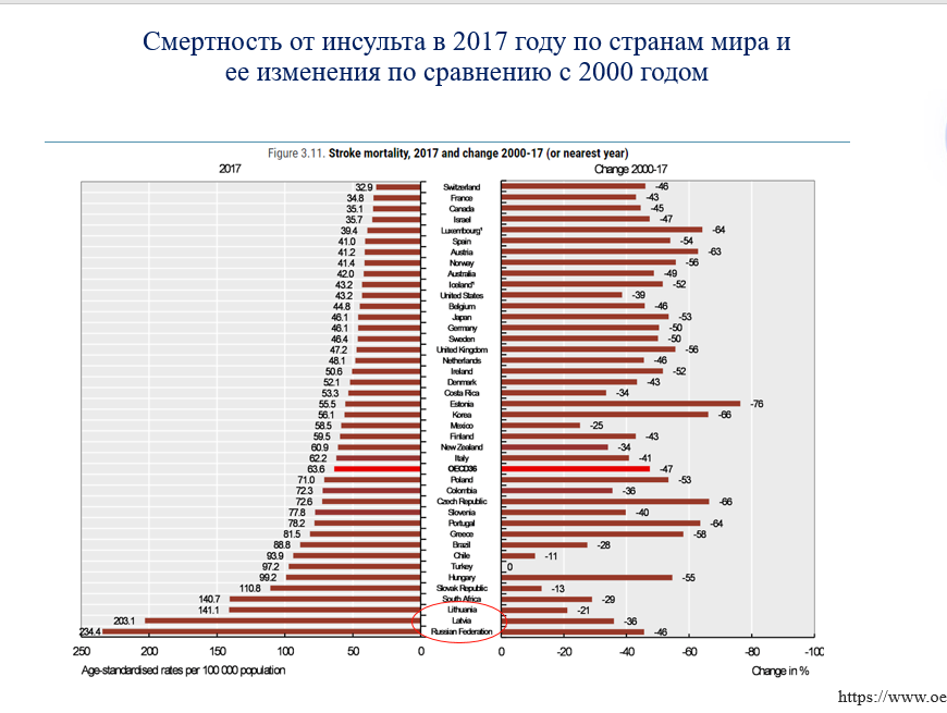 На первом месте по смертности от инсульта - Россия. Что-то мы явно делаем не так, как надо. В Швейцарии смертность от инсульта в 8 раз ниже