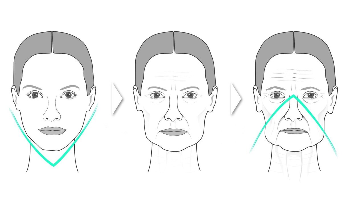 Возрастные изменения кожи. Фото из открытых источников 