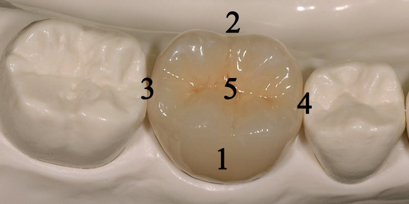 Пять поверхностей коронки зуба - на примере моялра