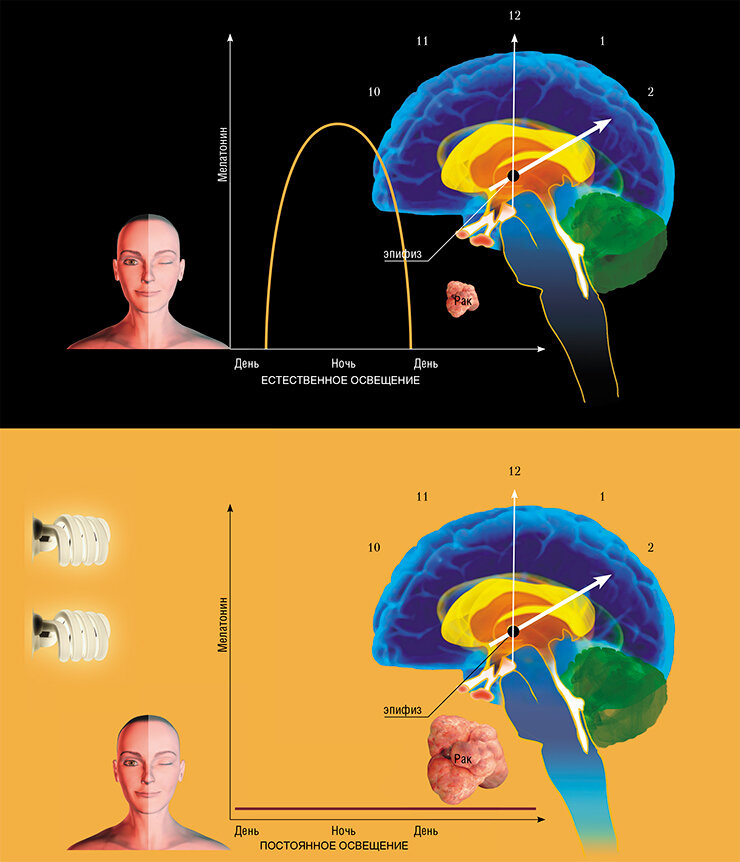 Гормон мелатонин, выделяемый нашими «биологическими часами» – эпифизом – в темное время суток, играет важнейшую роль в реализации противоопухолевого иммунитета