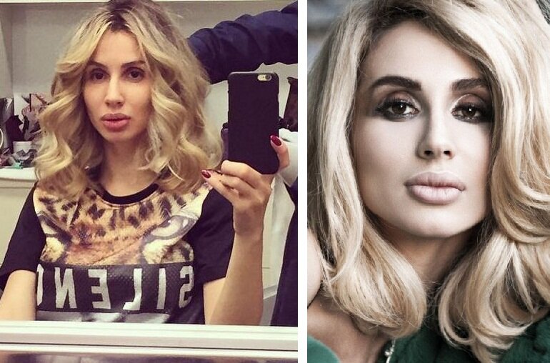 Светлана до и после пластики. Фотография с сайта infoplastika.ru