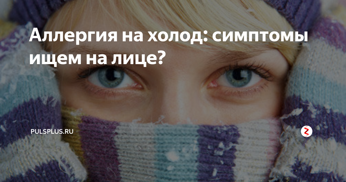 Аллергия на холод симптомы фото Аллергия на холод: симптомы ищем на лице? ПульсПлюс Дзен