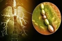 Обычно, воспаление легких подозревают при значительном повышении температуры тела. Она может подскакивать до 40 градусов. Но бывает ли пневмония без этого признака? Если болезнь имеет скрытое течение, то происходит незначительное повышение температурных показателей и люди часто не обращают на это внимания. Но существуют и другие симптомы пневмонии у взрослых, которые должны натолкнуть на мысль о необходимости посещения врача. К ним относят: