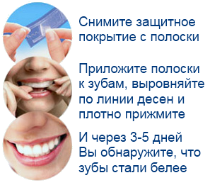 Источник: ozubkah.ru