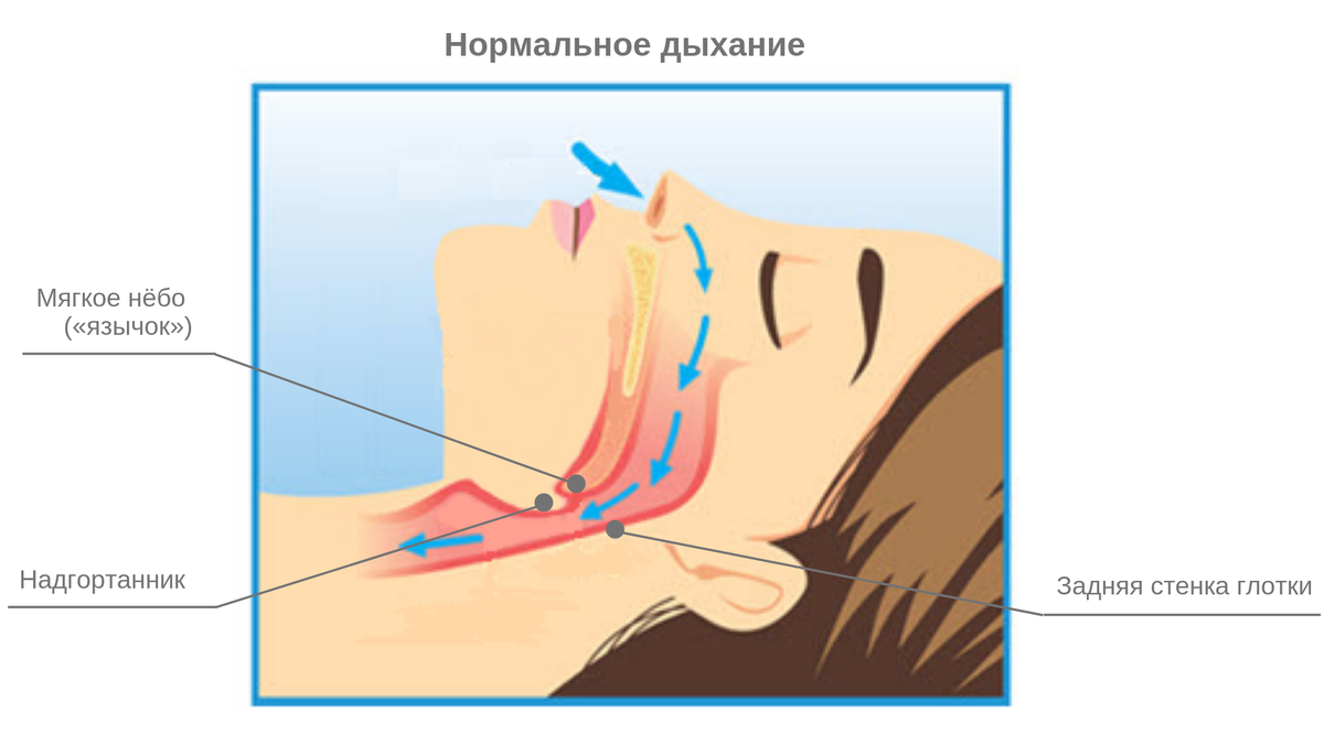 Кома храп