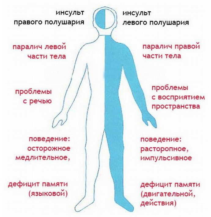 Жжение в спине в области лопаток - методы лечения, причины