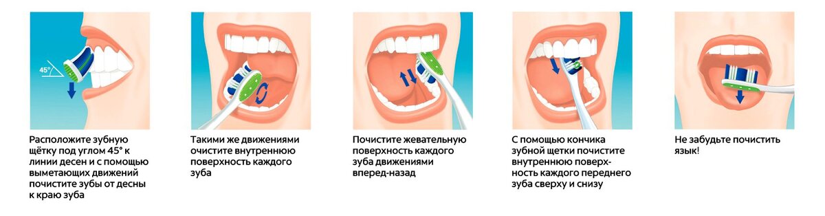 Техника очищения каждой поверхности зуба
