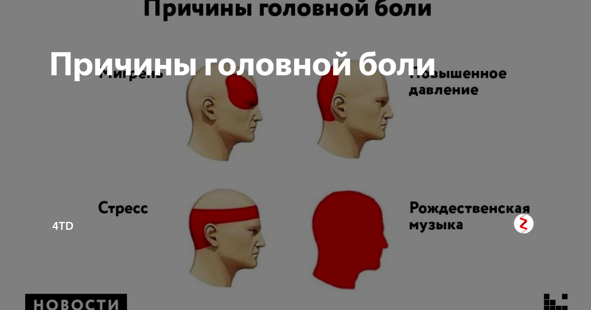 Почему болит голова. Причины головной боли. Зоны головной боли. Зоны головных болей головы. Головная боль локализация.
