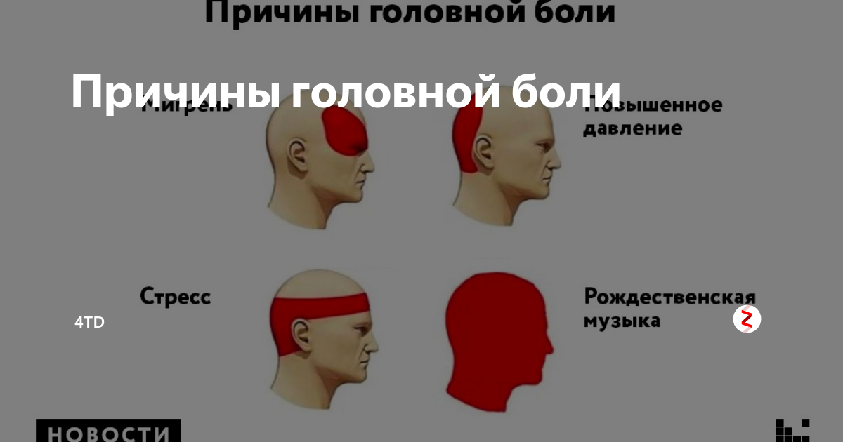 Болит голова к какому врачу идти. Локализация головной боли и причины. Болит голова. Головная боль части головы. Болит голова вэ.