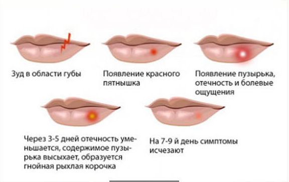 все фото взяты из открытых источников