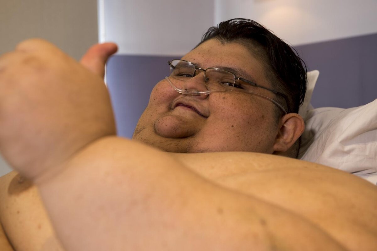 Самый толстый человек в мире в фото