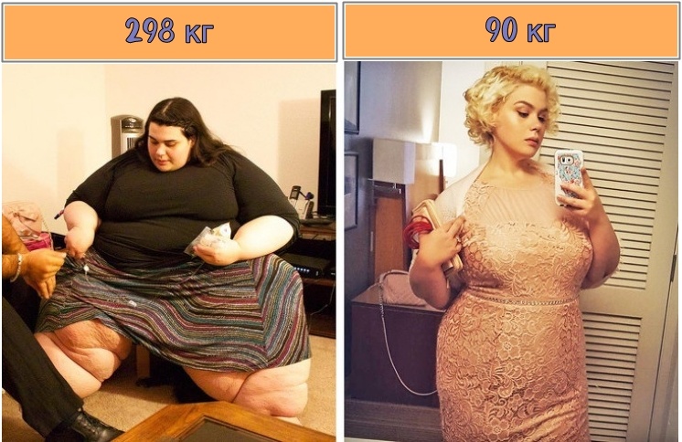 Источник https://yandex.ru/images/ Наша героиня ДО и ПОСЛЕ