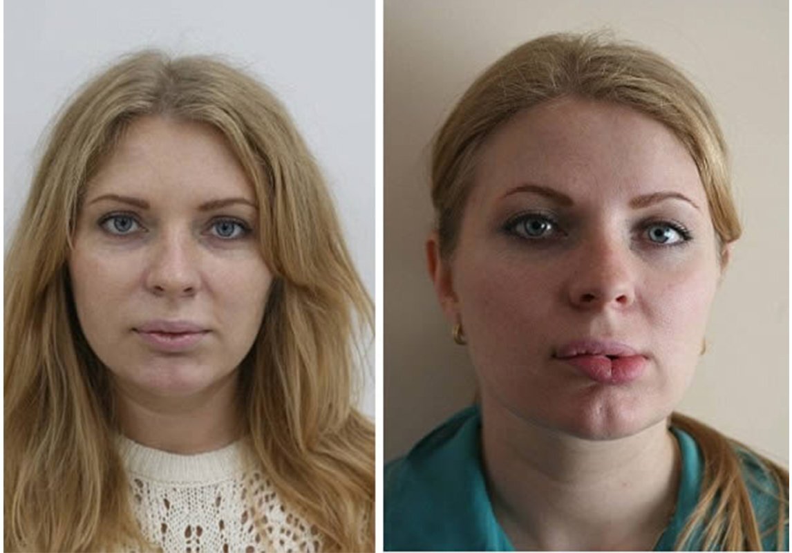 день последствия