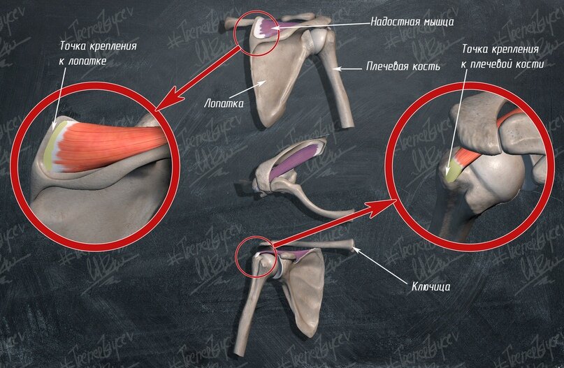 Анатомия плечевого сустава сухожилия надостной мышцы