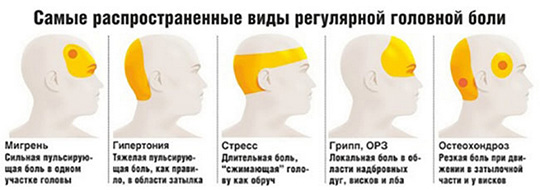 Лечение головной боли