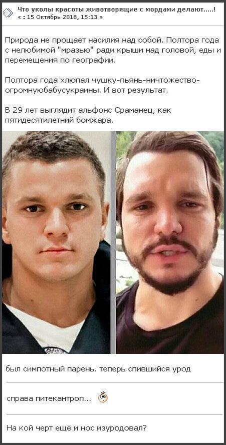 Гусев до и после пластики Юзеров соц. сетей поразили перемены во внешности Антона Гусева, произошедшие за 