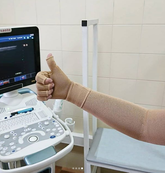 Пациент  отделения лимфологии "Центра Флебологии" оценивает результат лечения