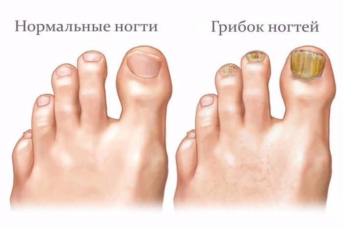 Более 7 500 работ на тему "Brittle Nails": стоковые фото, картинки и изображения