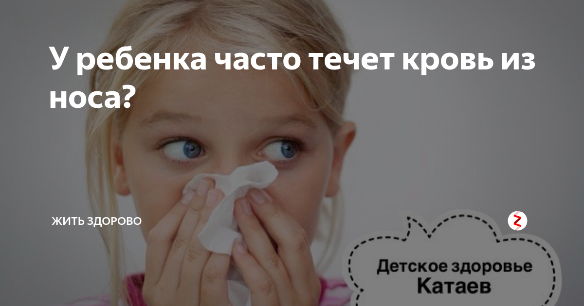 Часто кровь из носа у ребенка. Кровь из носа у ребенка причины. Причины кровотечения из носа.