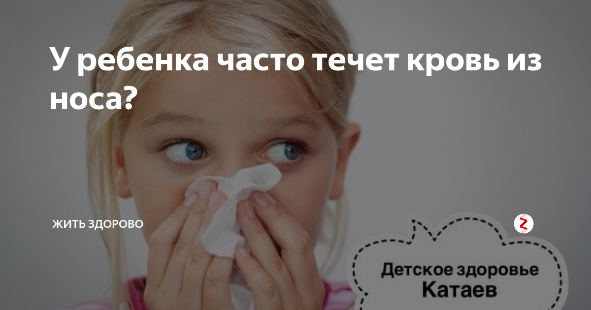 Ребенок 5 лет идет кровь из носа. Часто кровь из носа у ребенка. Носовое кровотечение у детей. Кровь из носа у ребенка причины. Причины кровотечения из носа у детей.