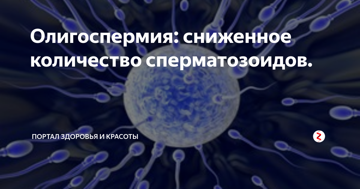 Олигозооспермия что это такое у мужчин. Олигоспермия. Олигоспермия тяжелой степени. Олигоспермия что это такое у мужчин. Олигоспермия степени.