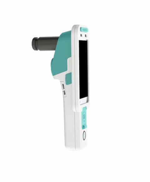 Электронный кольпоскоп со встроенным искусственным интеллектом 