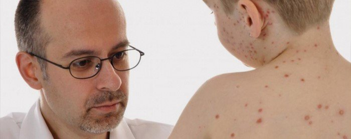 10 симпотом при сыпи в которых обязательно нужно обратится к врачу
