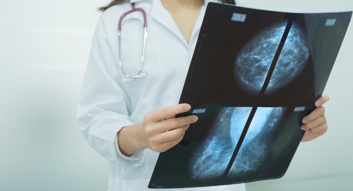 МАММОГРАФИЯ С ПРИЦЕЛОМ. Все ли «видит» исследование, которое считается ...