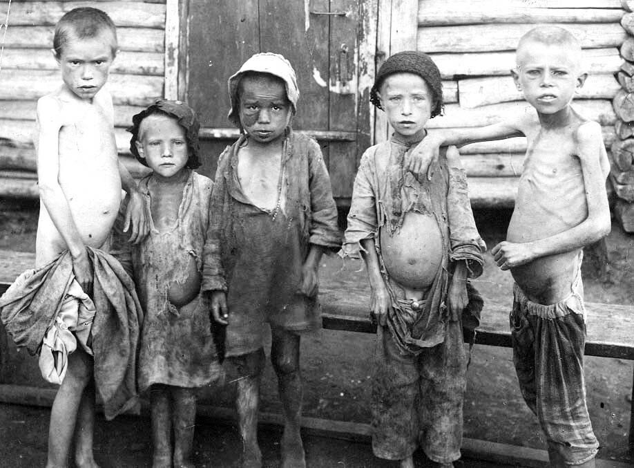 Фото. Голод 1921 года. Вот так пухнут от голода.