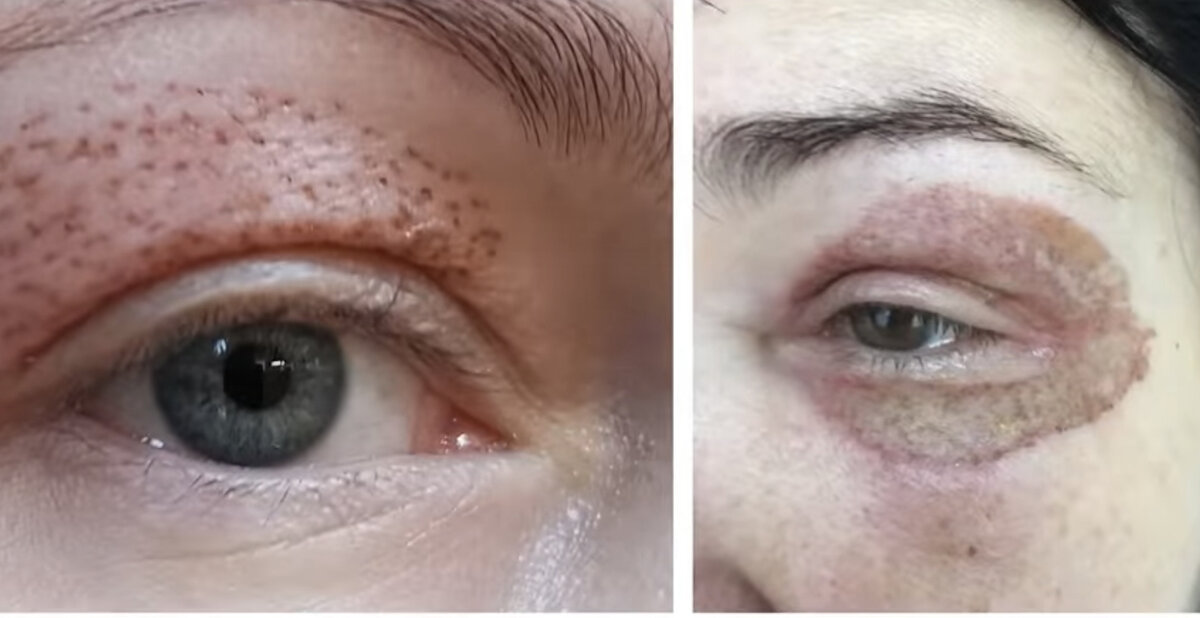 Последствия холодной плазмы