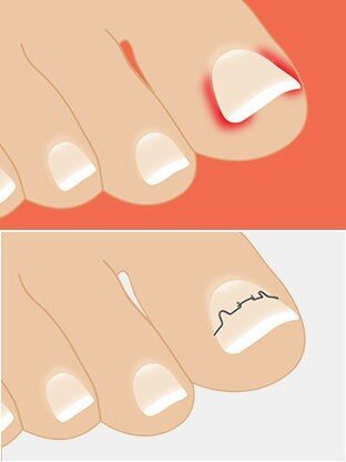 (orthos-прямой, onyx-ноготь)