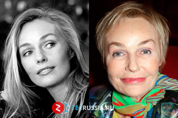 Андрейченко до и после пластики фото