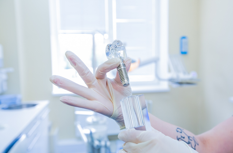 Гарантия на имплантацию зубов: рассказываем все, что вы должны знать ...