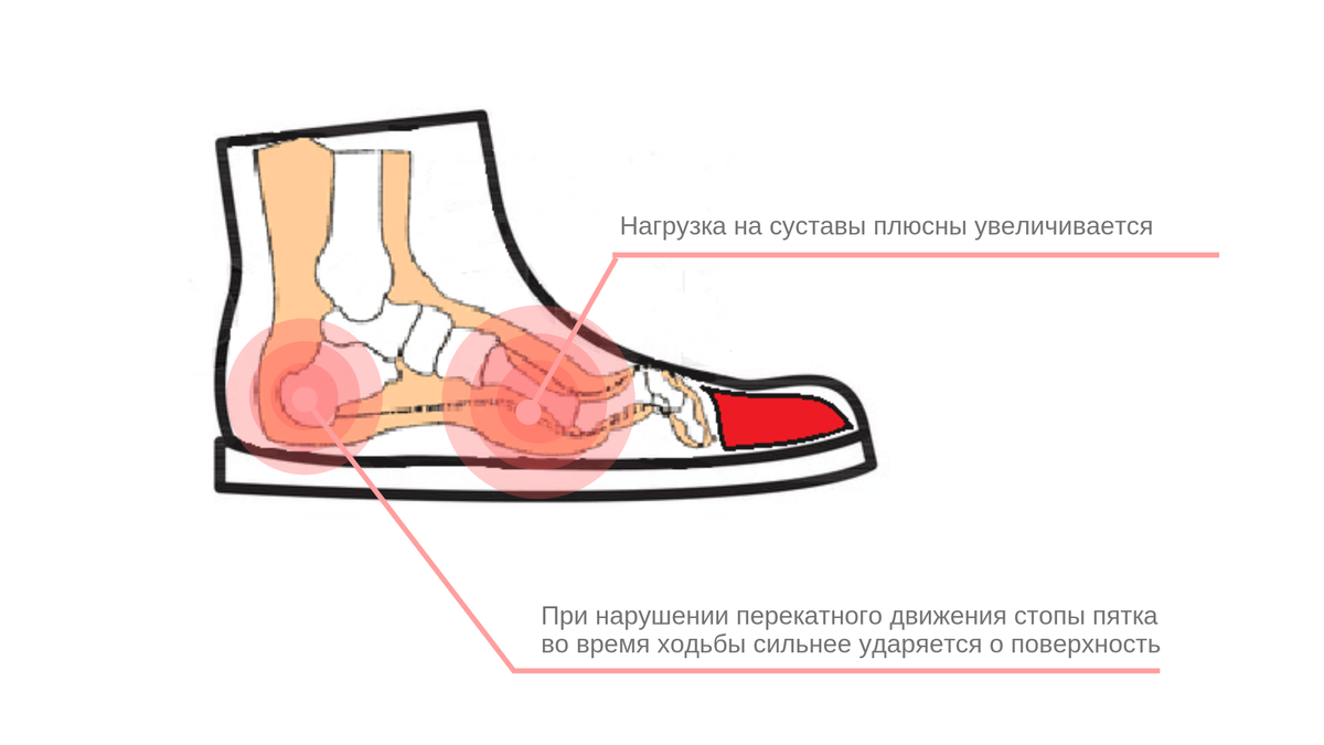 Обувь на вырост - в помойку! Почему опасно постоянно носить обувь которая вам велика?
