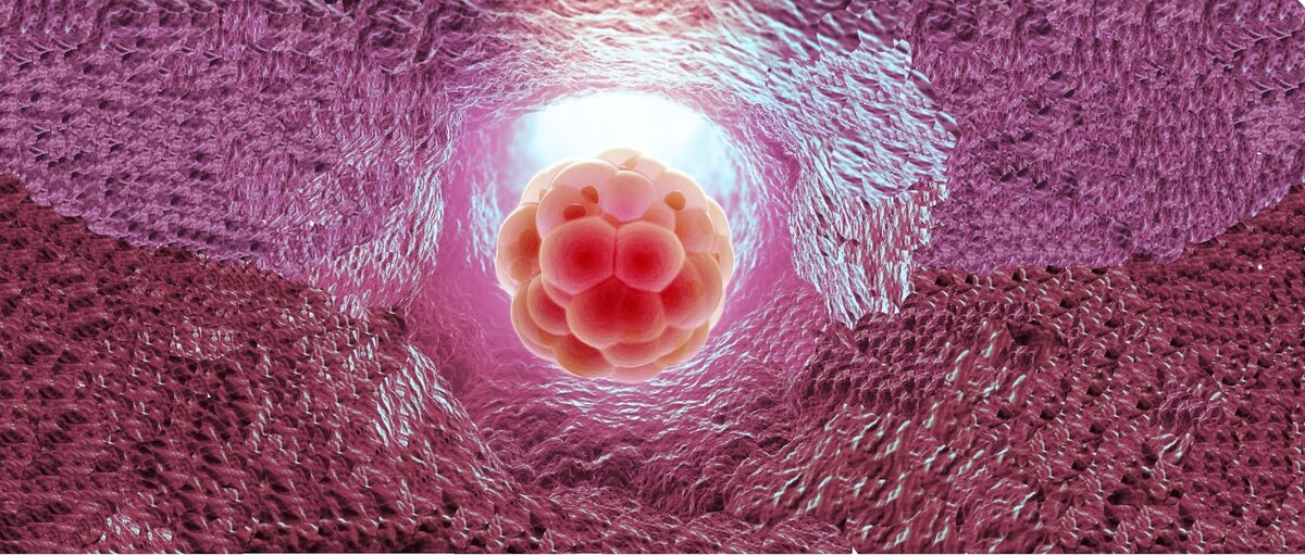 Источник Яндекс картинки