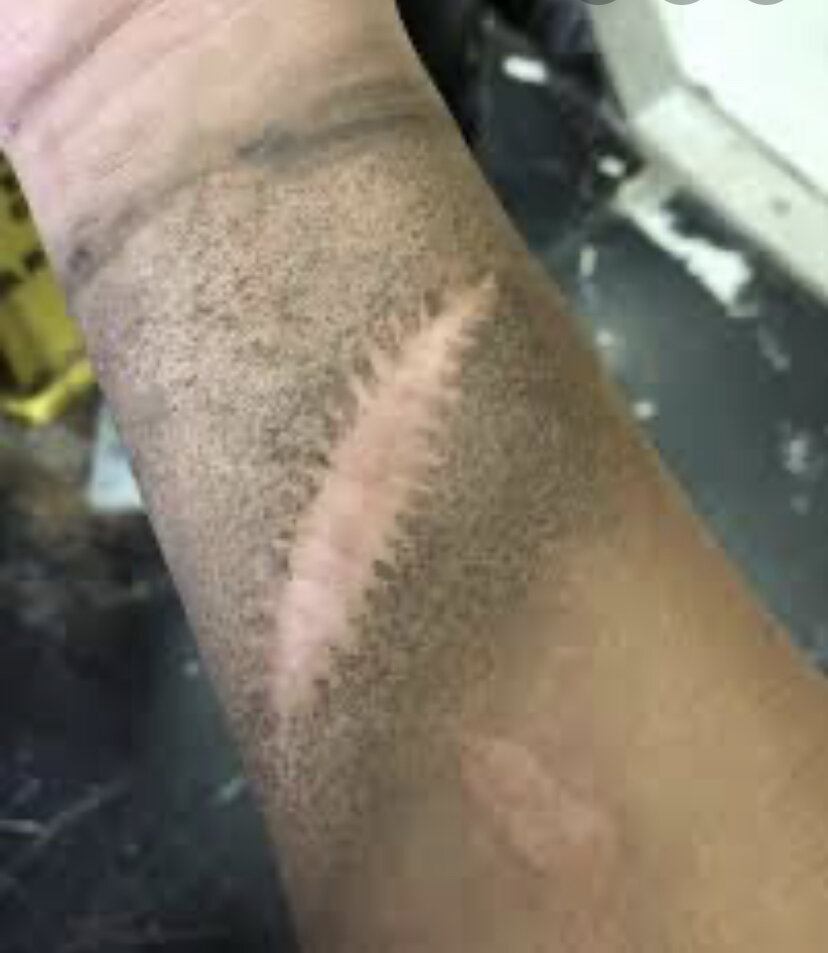 Шрамы не потеют 