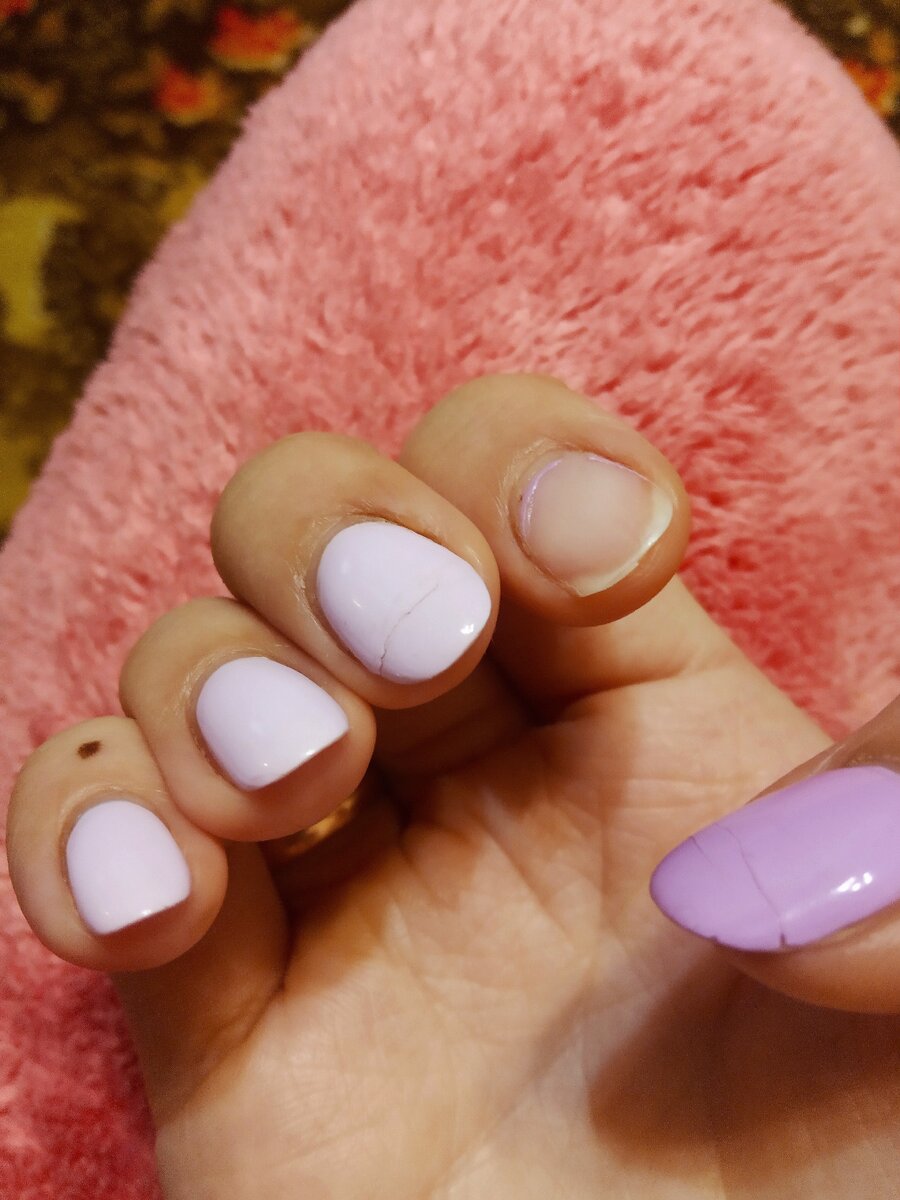 Вот такое убожество у меня сейчас на руках. Смотреть неприятно. Не понимаю, что пошло не так. Маникюр делала не дилетант.