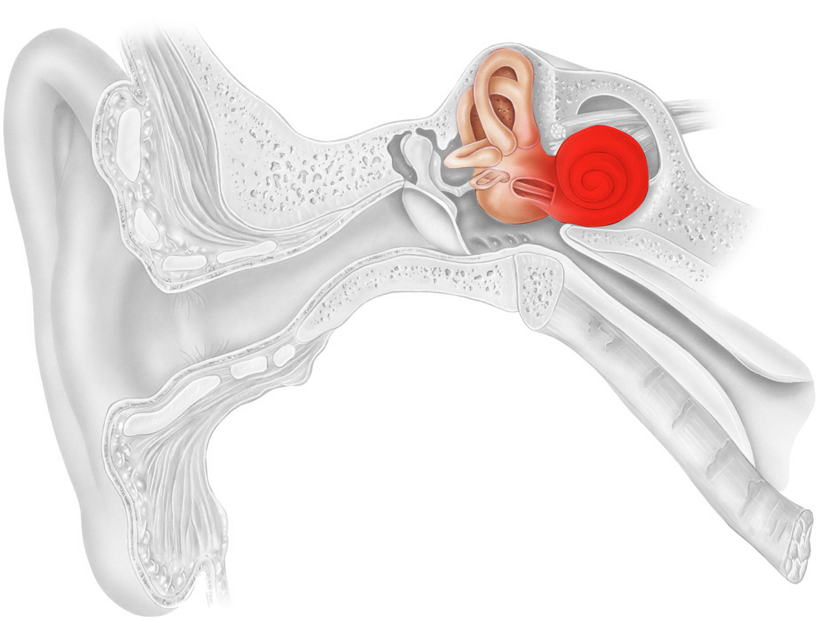Отит внутреннего уха. Почему болезнь нельзя запускать | Медицинский центр  Е.В. Малышевой | Дзен