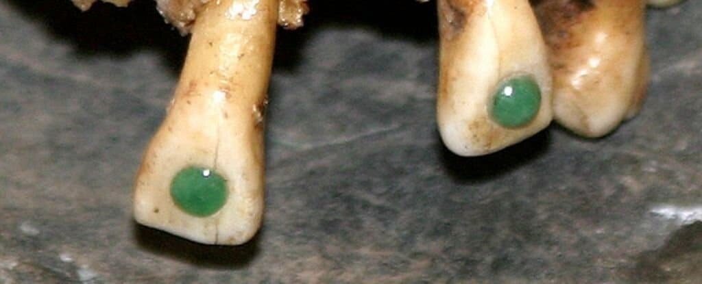    Зубы древних майя, инкрустированные нефритами / ©www.sciencealert.com