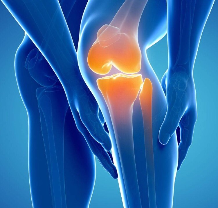 Так что же там болит? Колено - это собирательное понятие. Любая боль в колене у человека автоматически ассоциируется с артрозом коленного сустава.